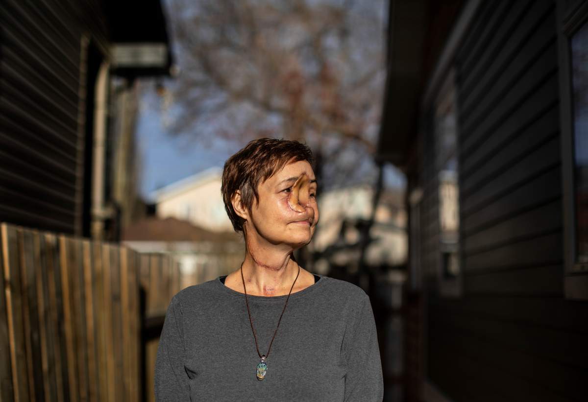 Sharon Durham pictured in Edmonton on Monday November 8, 2021. Durham had her rare cancer surgery cancelled in Saskatchewan and then rescheduled in Edmonton when Alberta was at the peak of its fourth wave.