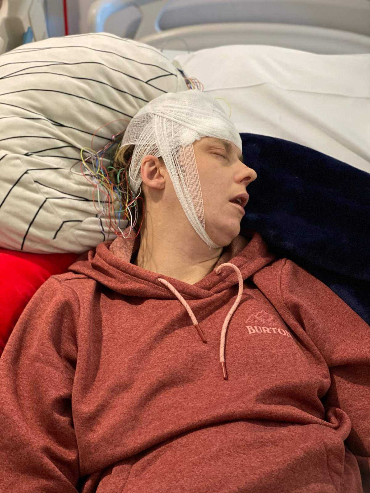 The SHA CEO said it might take a year and a half for orthopedic surgeries to resume. A patient in dire need of a kidney says she won’t be alive if she needs to wait that long.