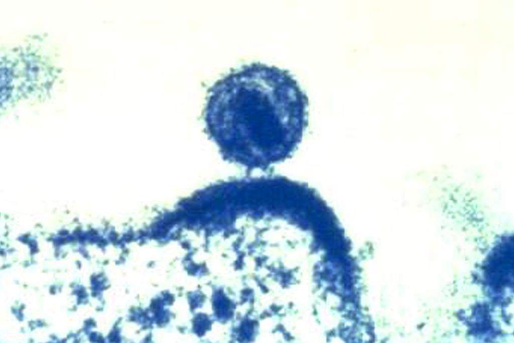HIV