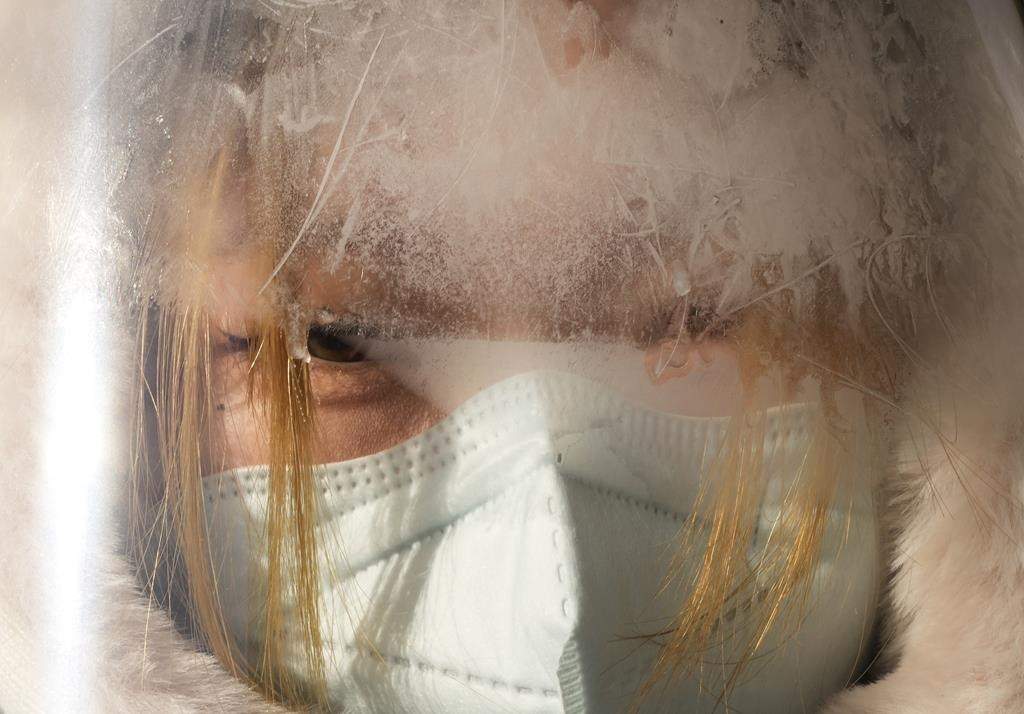 Frost covers a face shield of a volunteer before the start of the women’s 7.5km + 7.5km skiathlon cross-country skiing competition at the 2022 Winter Olympics, Saturday, Feb. 5, 2022, in Zhangjiakou, China.