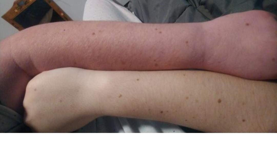 kaytlyn mckibbon tos arms photo