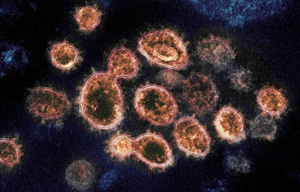This transmission electron microscope image shows SARS-CoV-2, the virus that causes COVID-19, isolated from a patient in the U.S. Virus particles are shown emerging from the surface of cells cultured in the lab. The spikes on the outer edge of the virus particles give coronaviruses their name, crown-like. Image captured and colorized at NIAID's Rocky Mountain Laboratories (RML) in Hamilton, Montana.