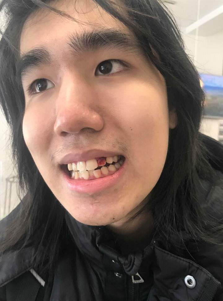 Dallas Ly, 20.