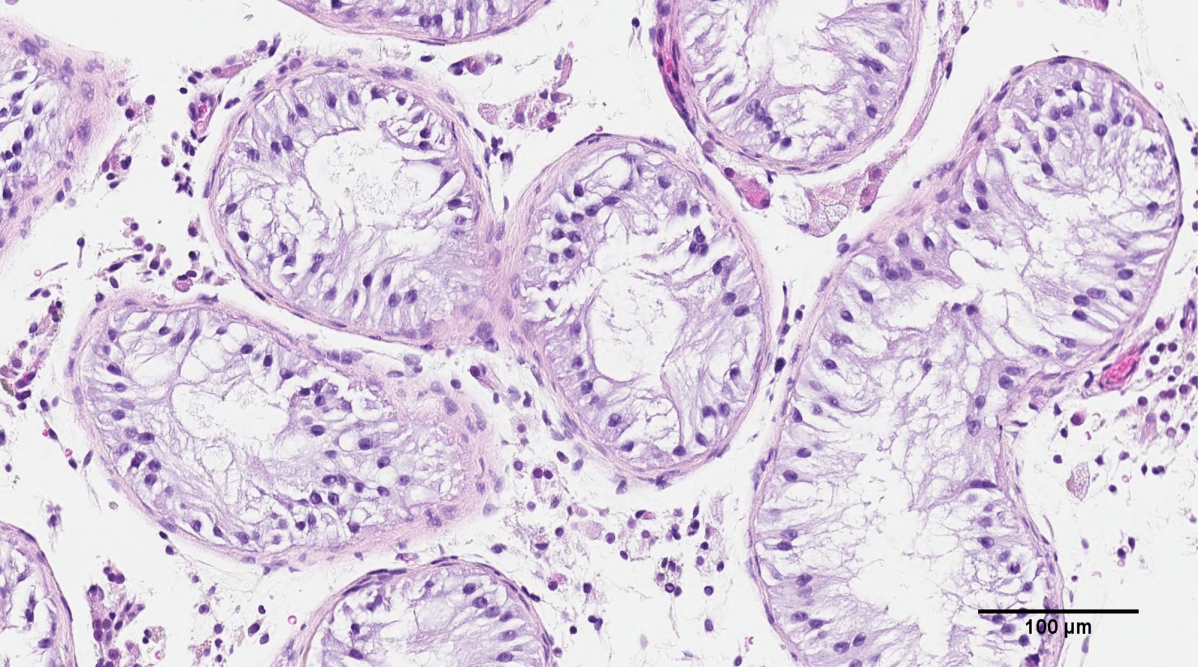 Biopsy of testicular cells used for printing