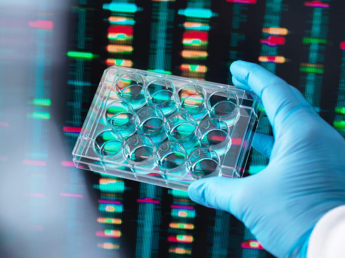 Scientist holding up a multi well plate containing DNA samples with results on the computer screen