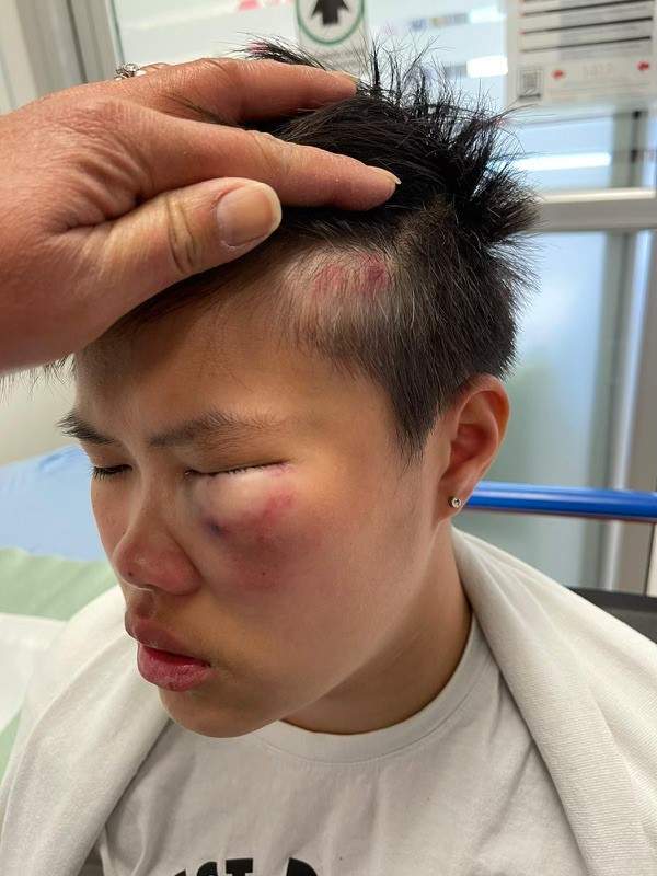 Richmond RCMP are investigating an alleged assault a local secondary school. Grade 9 student Janice Xie, seen here on Thurs. April 21, 2022, said an older student beat her unconscious that day at Hugh Boyd Secondary School in Richmond, B.C.
