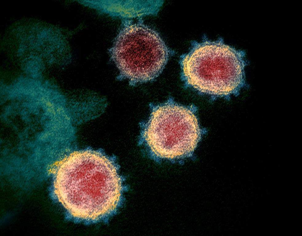 Saskatchewan officials report in the latest epidemiology report that COVID-19 activity is increasing in the province with 1524 new cases, 27 new deaths.