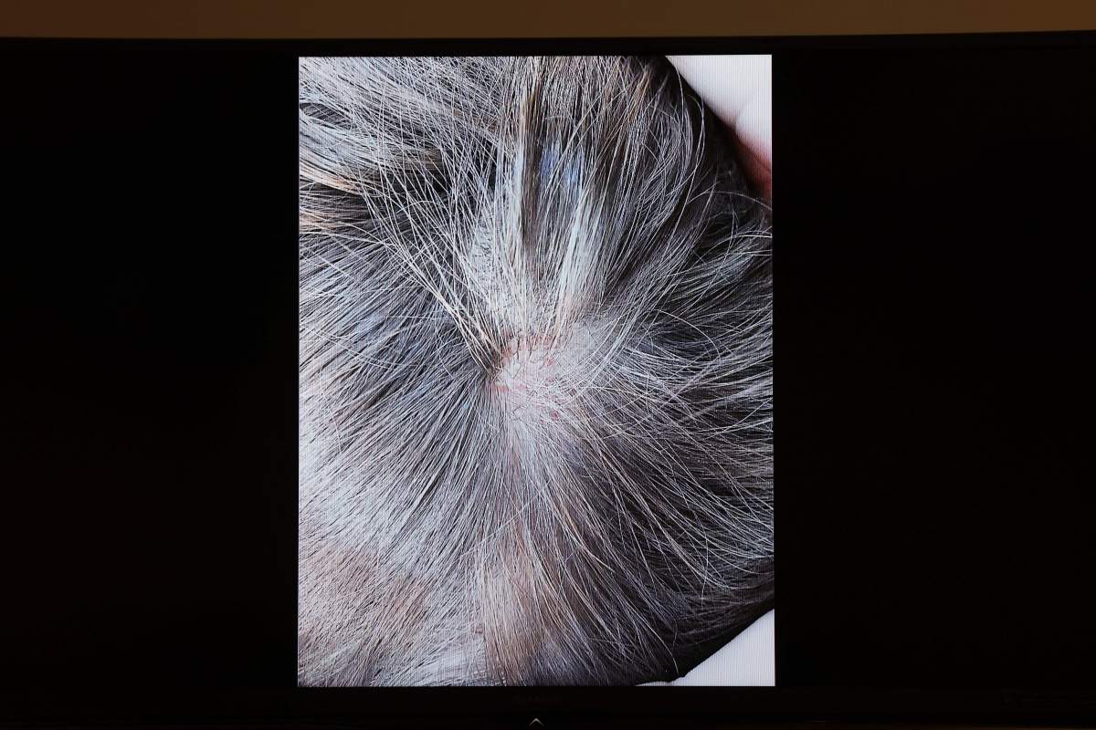 Evidence showing a picture of Amber Heard’s hair appear on a screen during a defamation trial at the Fairfax County Circuit Courthouse in Fairfax, Virginia, on May 5, 2022.