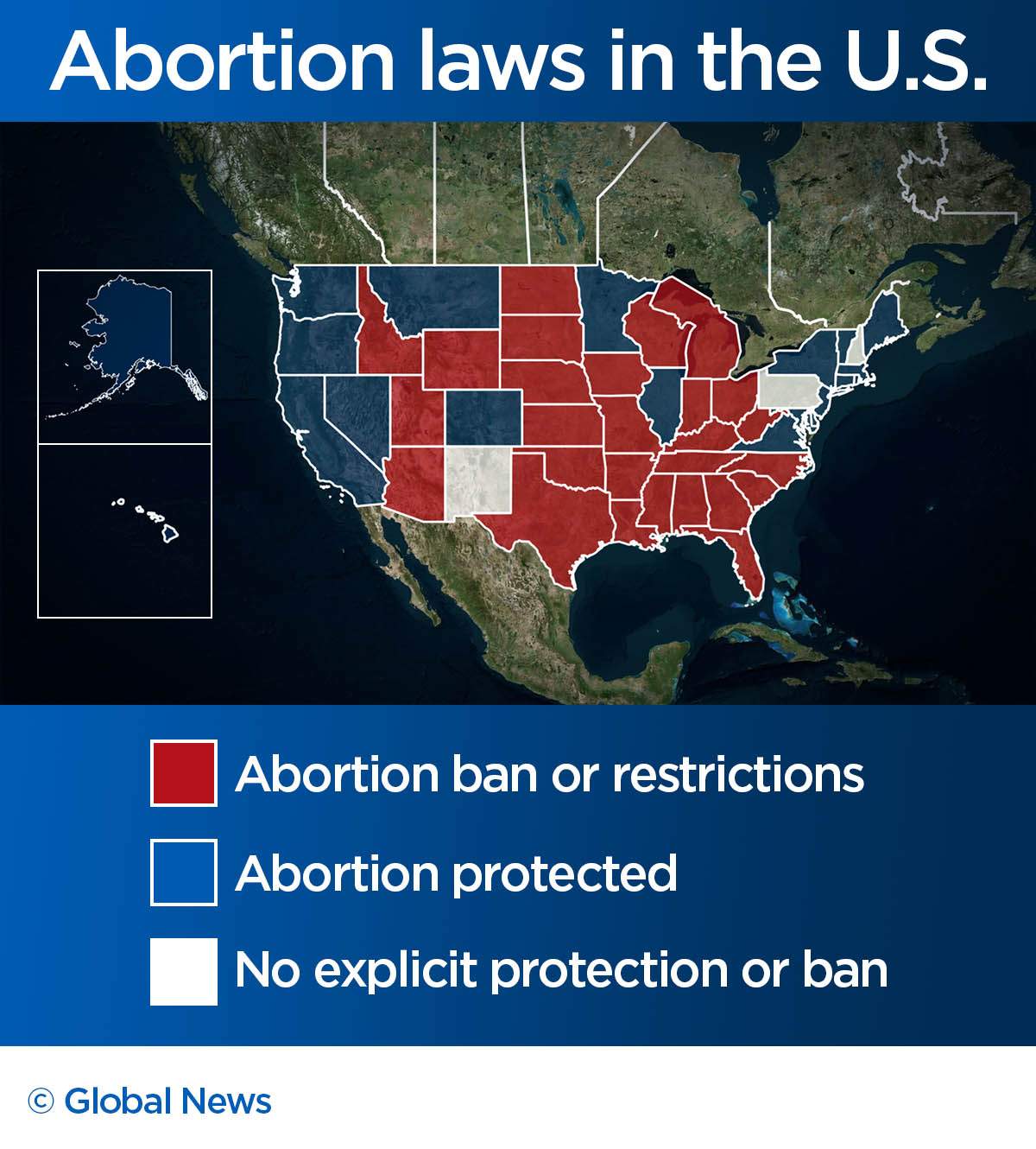 How abortion access differs across U.S. — and how overturning Roe v. Wade could change it - image