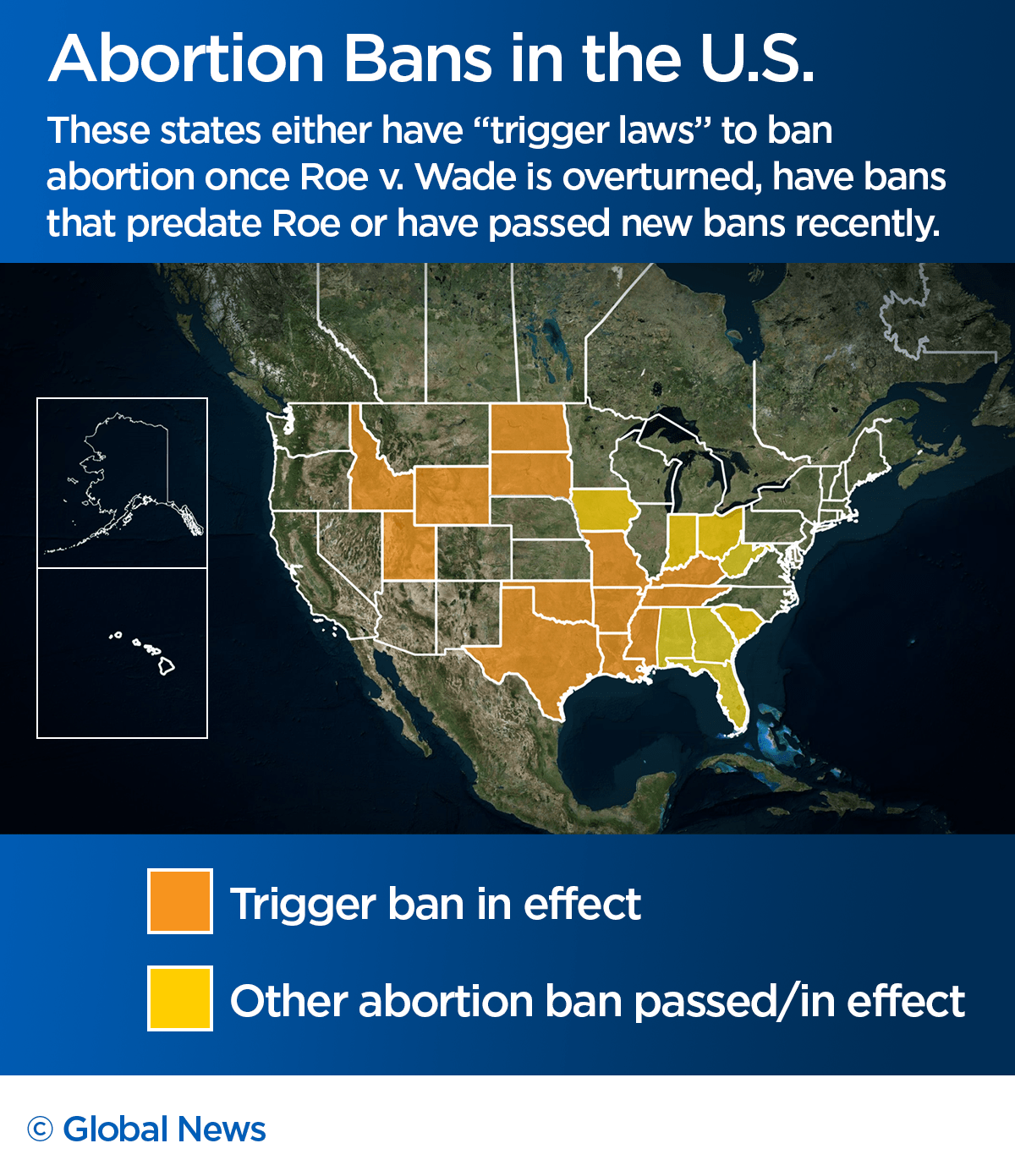 States move quickly to ban abortion after Roe v. Wade. Here’s what access will look like - image