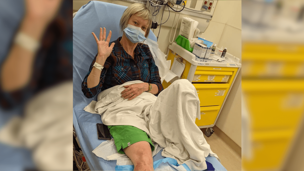 Tamara Dufour needed about 30 stitches after she was 'mauled' by a dog at Iroquoia Heights near the Chedoke Rail Trail on June 23, 2022.
