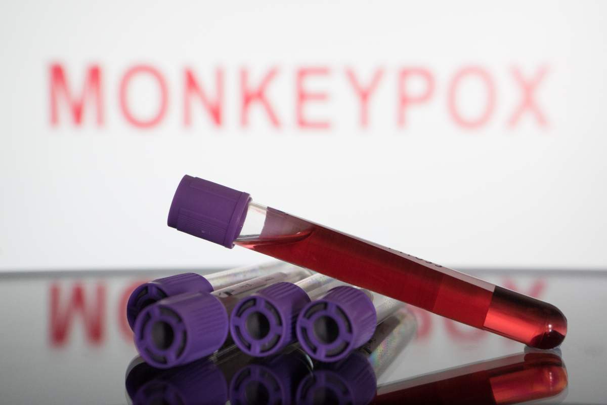 Monkeypox Photo Illustrations