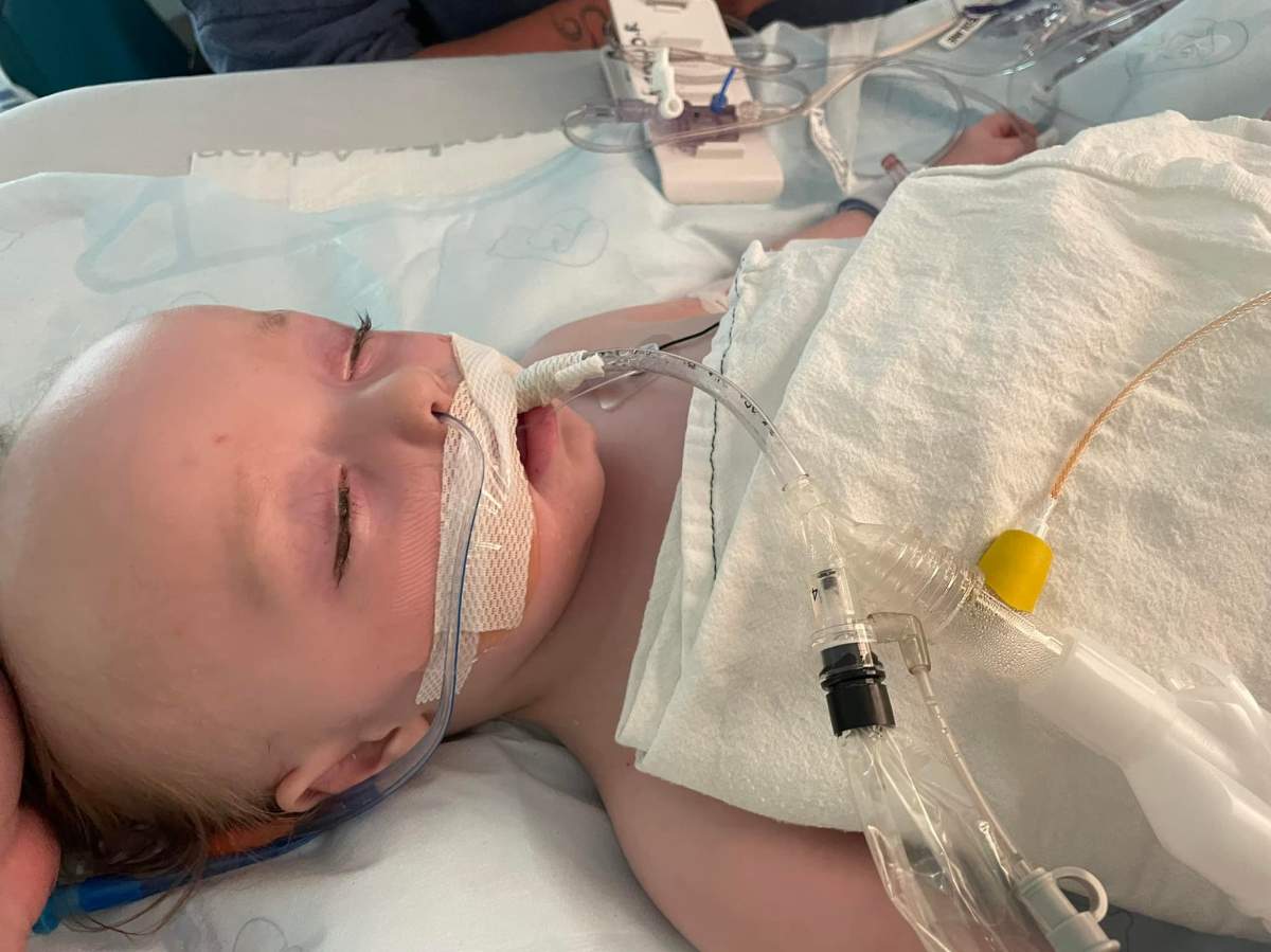 Toddler inhales hot wax