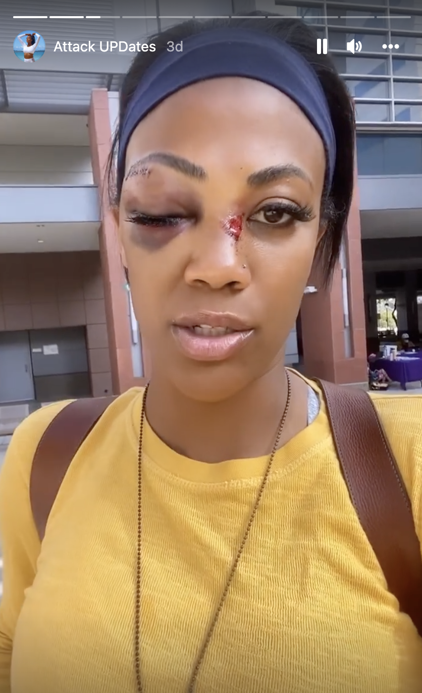 A screenshot from Kim Glass' Instagram story recounting how she was attacked.