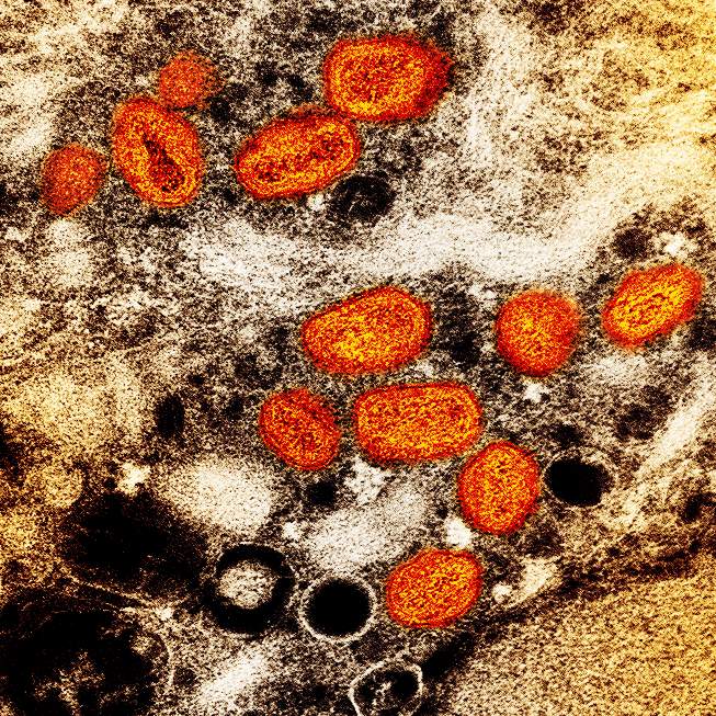 Monkeypox Canada