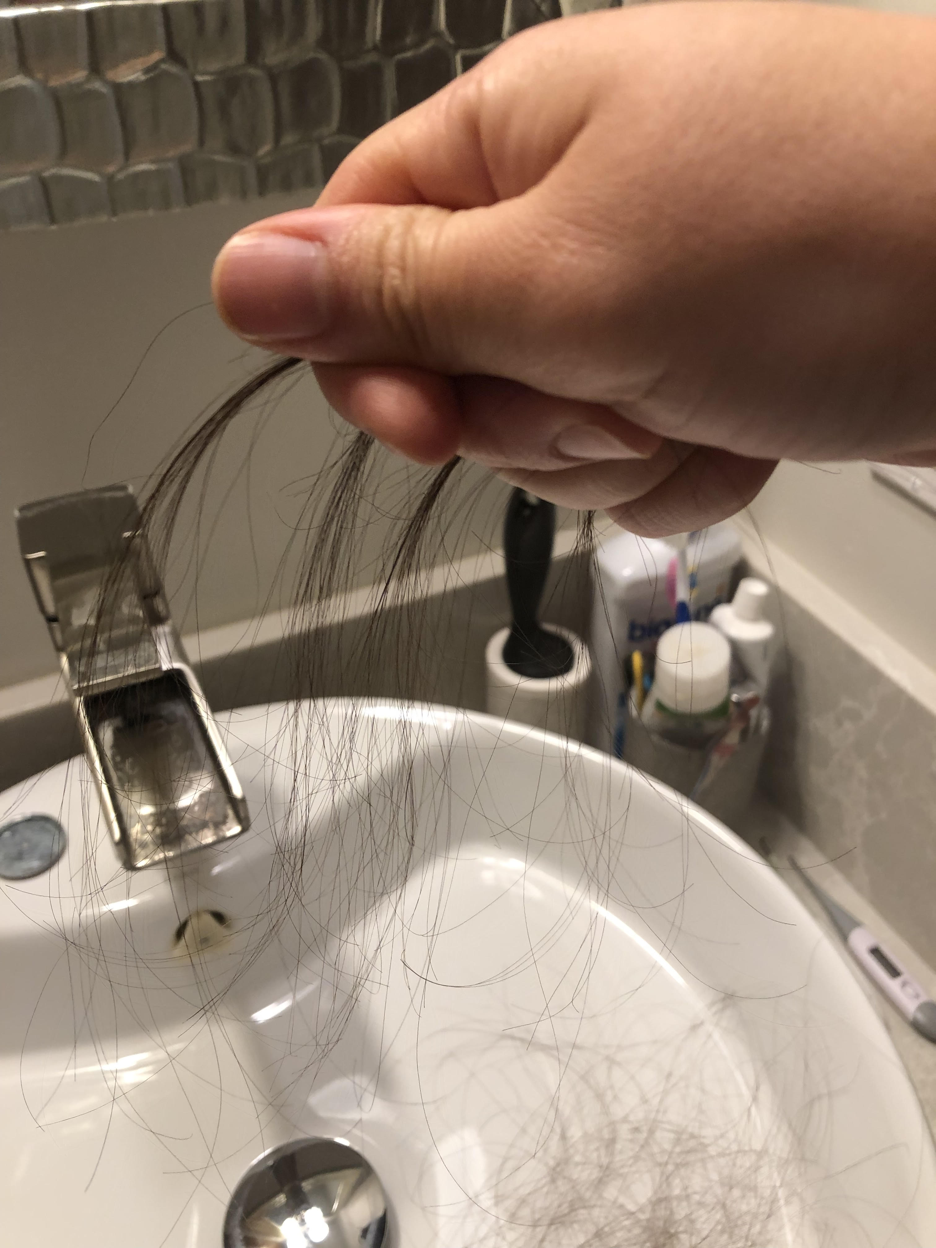 The hair started falling out by the fistful a couple of weeks after my first chemotherapy infusion.