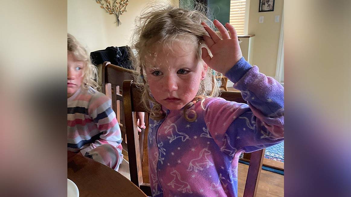 Two young girls who visited their grandparents in the Okanagan in July wound up with facial swelling after picking Myrtle spurge, an invasive plant with blue-green leaves and yellow flowers.