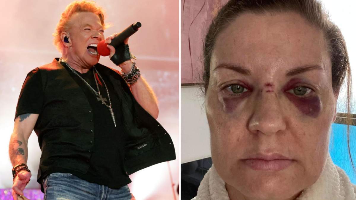 A split photo. On the left is Axl Rose on stage. On the right is Rebecca Howe, who claimed to have been hit in the face with a microphone at a Guns N' Roses concert.