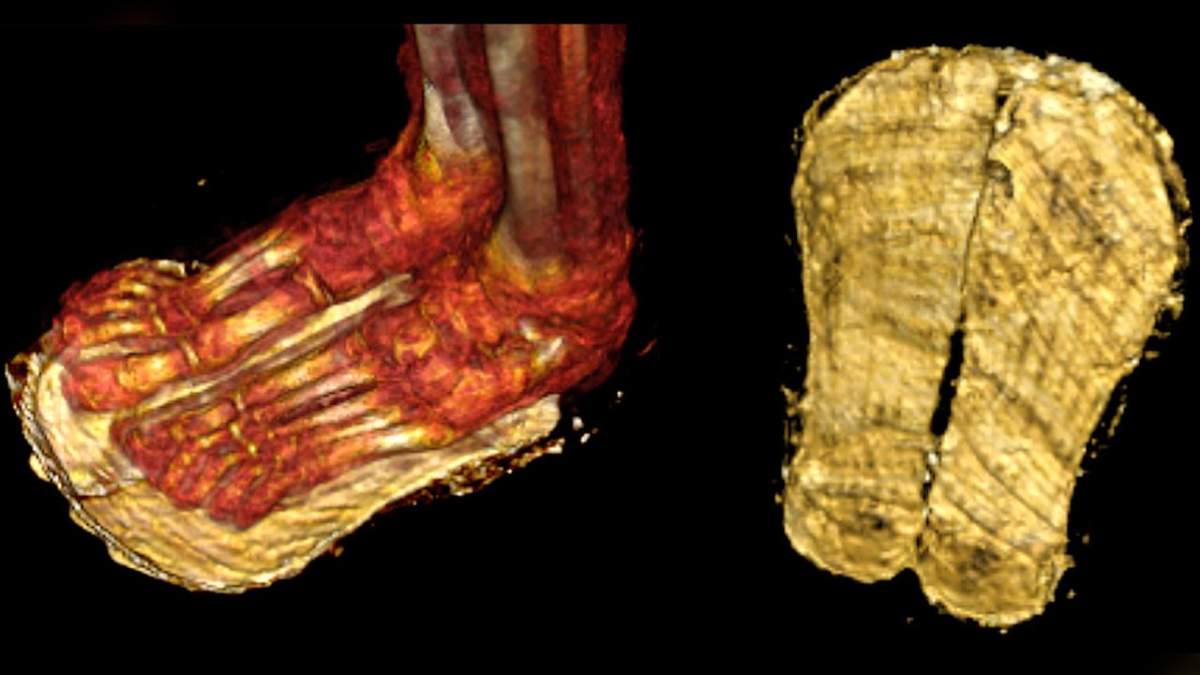 A pair of open sandals without strips were placed on the soles of the mummy’s feet.