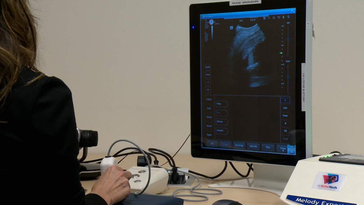 Dr. Nadine Kanigan gave a demonstration of how a remote ultrasound system can help patients she can’t see in person.