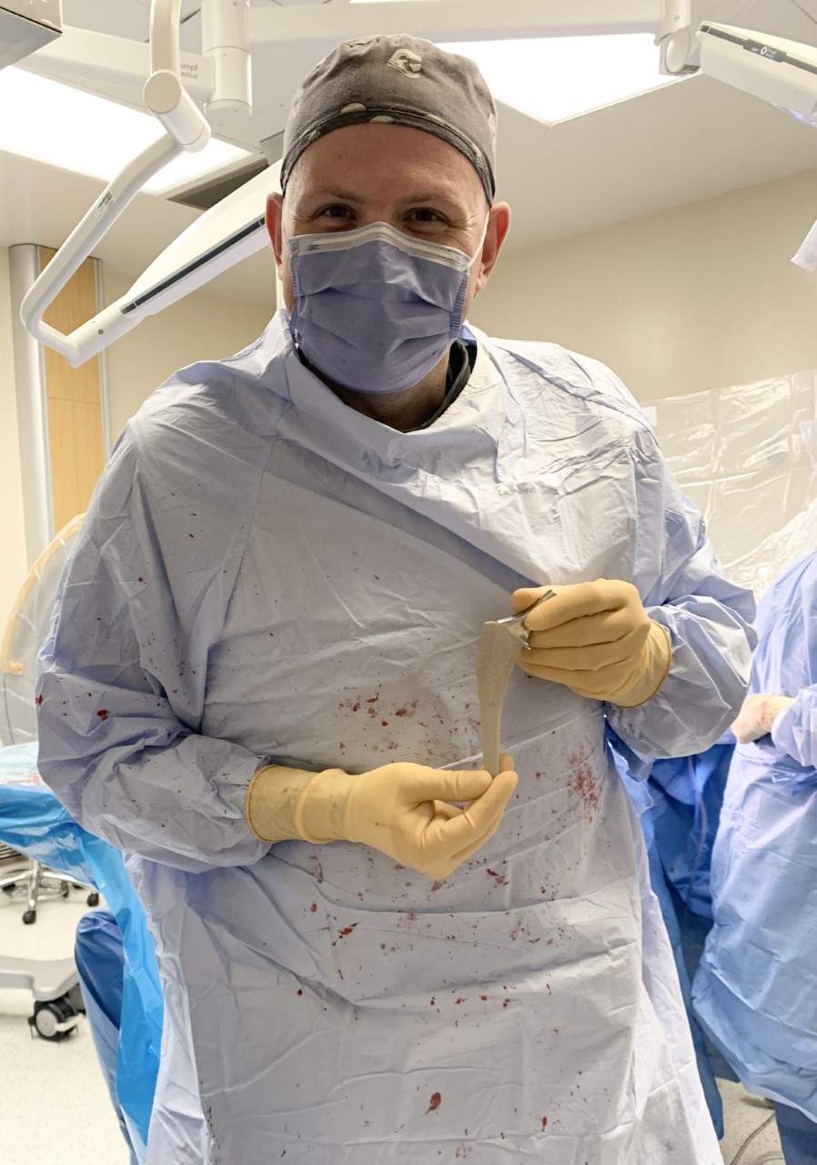 Dr. Sebastian Heaven with the first Insignia femoral stem implant used in hip arthroplasty surgery in Ontario at Ross Memorial Hospital on Feb. 15, 2023.