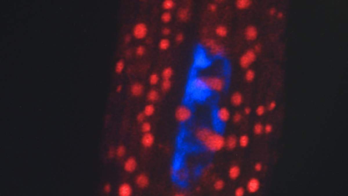 Lipid droplets in a cell