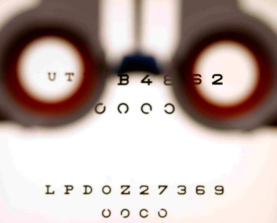 An optometrist holds glasses in front a lightbox during an eyesight test in Bremen, Germany, on Friday, Jan. 16, 2009. Ontario Health Minister Sylvia Jones is defending changes to optometry coverage that reduce the frequency of eye exams for healthy seniors, saying a new agreement strengthens care for people with eye conditions. THE CANADIAN PRESS/AP-Joerg Sarbach.