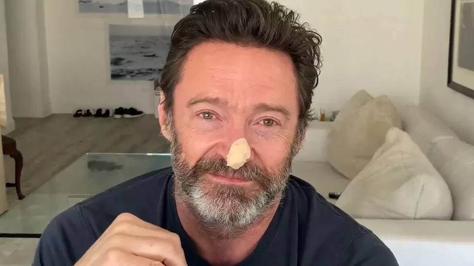 Hugh Jackman with a bandage on his nose.