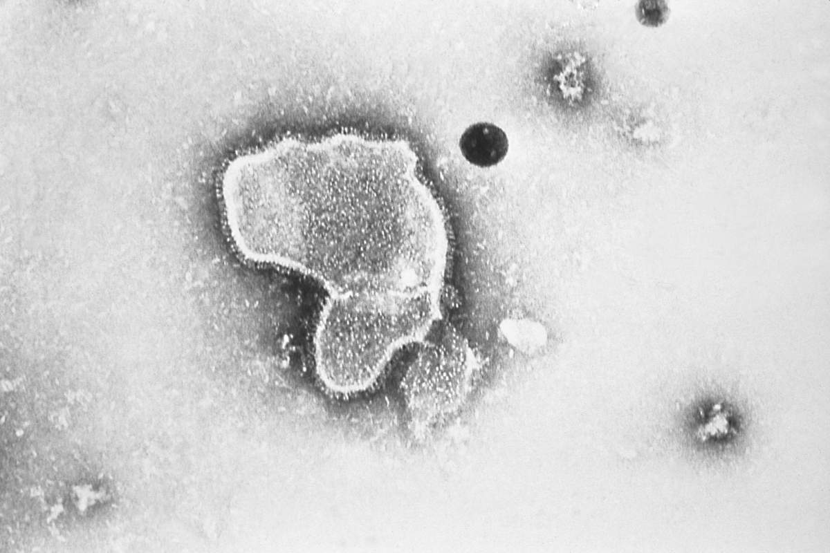 rsv-antibody-drug-approved