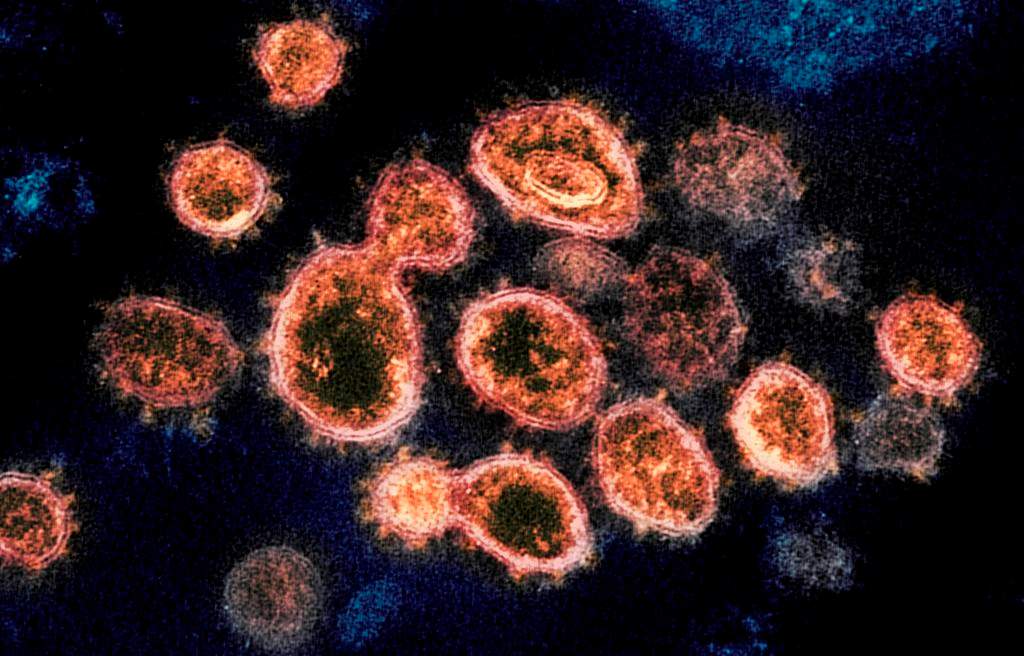 An outbreak of COVID-19 has been declared at the South Muskoka Memorial Hospital site in Bracebridge, Ont. The outbreak currently includes eight patients and six staff across four inpatient units.. File photo - THE CANADIAN PRESS/AP-NIAID-RML via AP.
