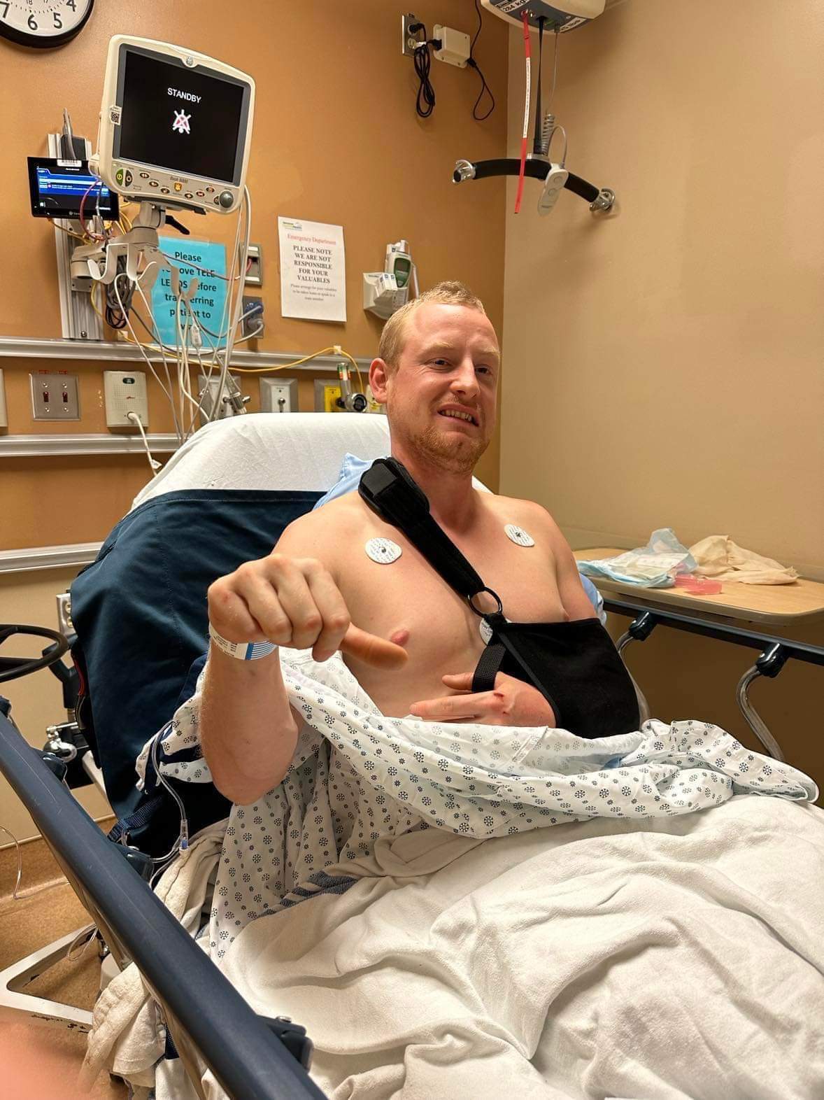 Kevin Milner suffered serious injuries after he hit a bear while riding his bike.