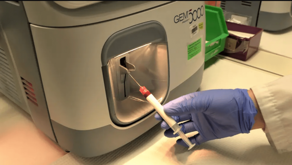 A new study published by the Lawson reach team showcases their discovery of unique patterns of blood plasma proteins in suspected long COVID patients.
