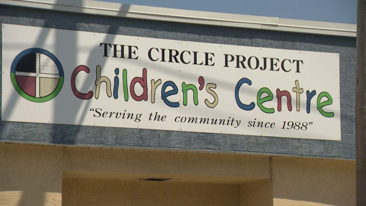 Regina mom fights for answers after son comes home from daycare with unexplained marks - image