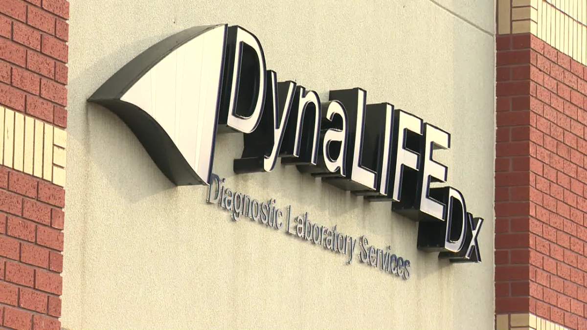 The Alberta government's failed deal with Dynalife to take over most lab services in the province was plauged by complaints of long wait times poor service.
