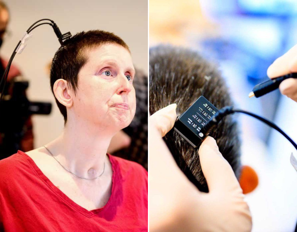 Ann Johnson, 47, can speak out loud again for the first time after she was paralyzed in a stroke that happened in 2005.