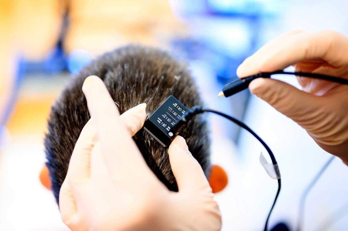 A researcher plugs a wire into a port that is screwed into Ann Johnson's head, which is connected to the grid of electrodes resting on her brain.