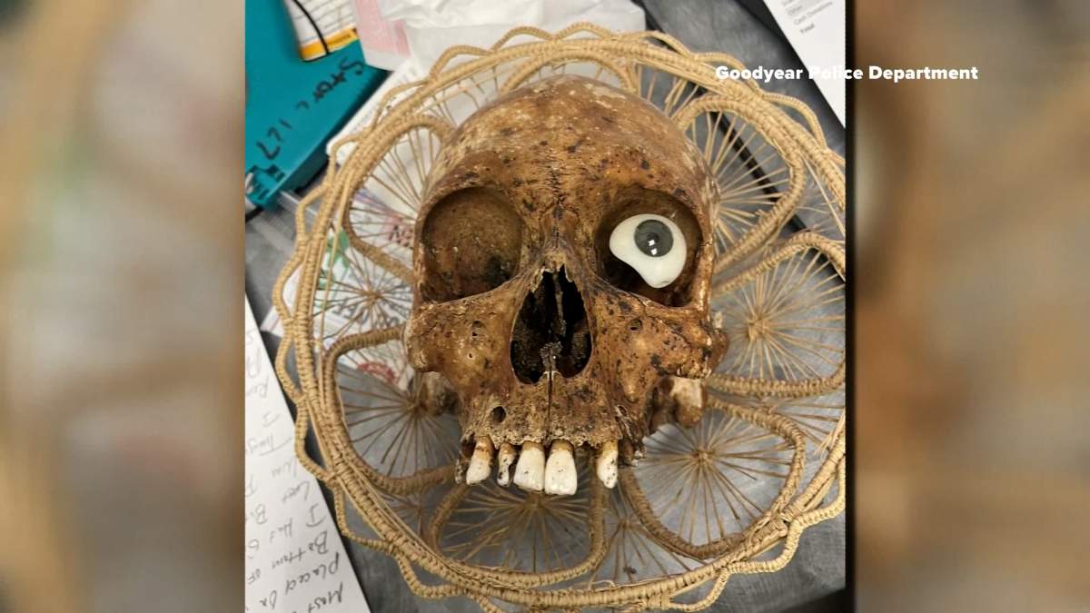 Police took possession of the human skull found in the box and transported it to the medical examiner's officer for further investigation.