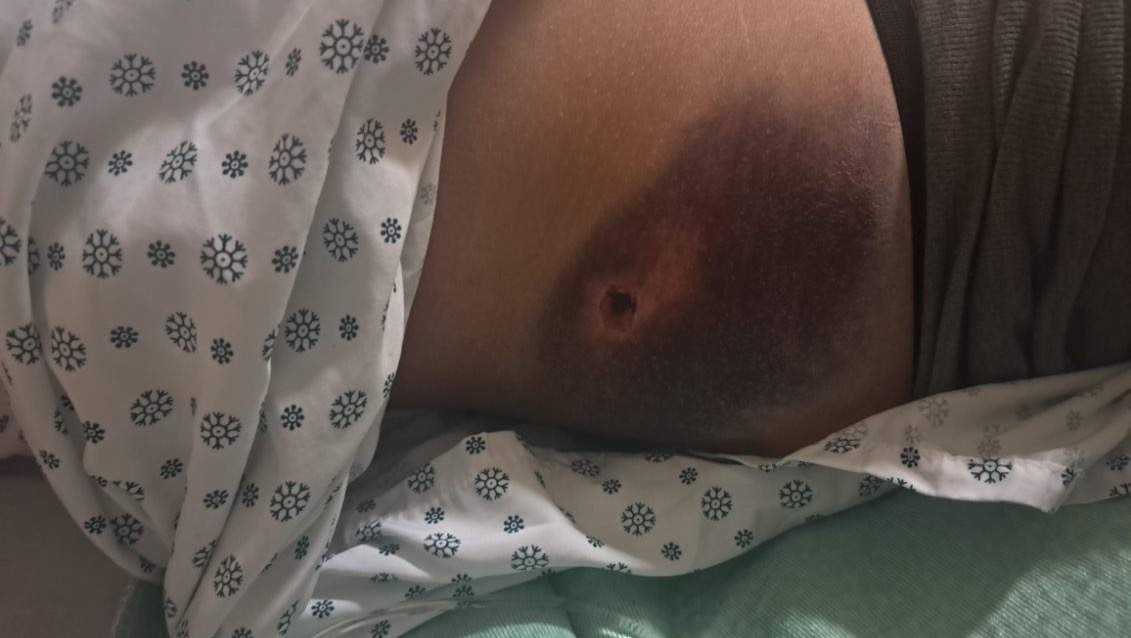 Alberta tow truck driver Cory Armstrong struck while working.