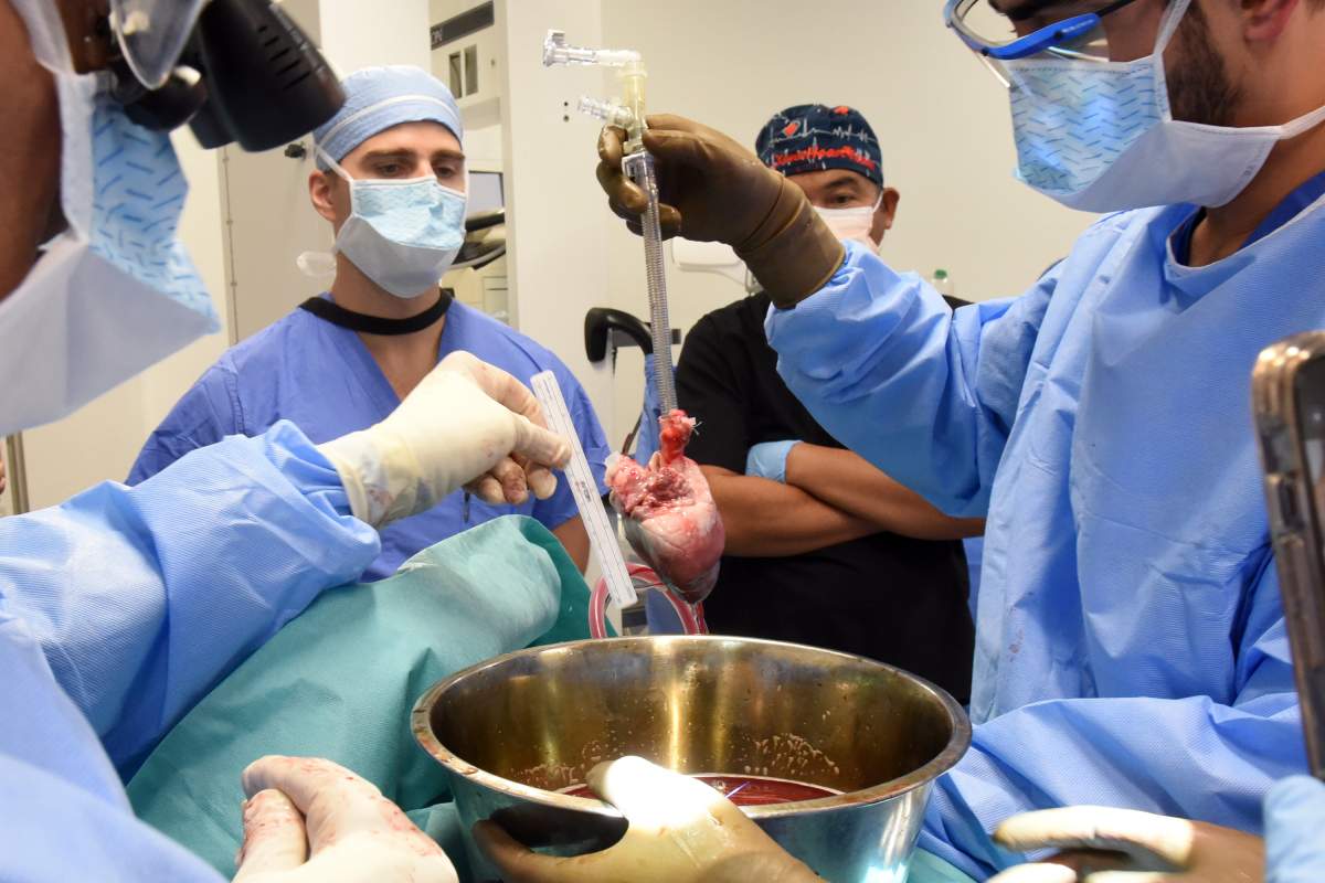 In this photo provided by the University of Maryland School of Medicine, surgeons prepare for a pig heart transplant into Lawrence Faucette at the school's hospital in Baltimore, Md., in September 2023. Two days after the transplant, Faucette was cracking jokes and able to sit in a chair, doctors said Friday, Sept. 22, 2023. (Deborah Kotz/University of Maryland School of Medicine via AP)