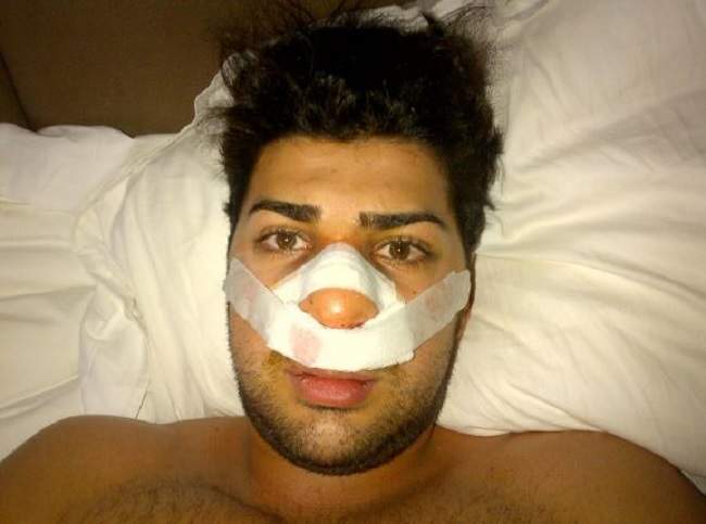 Police seized several electronic devices from Rabih Alkhalil. He appeared to have taken several selfies while recovering from nose surgery. 