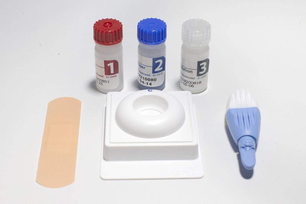 The Test@Home HIV self-test kit is pictured in Toronto on Friday April 16, 2021. Montreal's regional public health authority reports the area recorded its highest number of new HIV diagnoses in 10 years in 2022. 