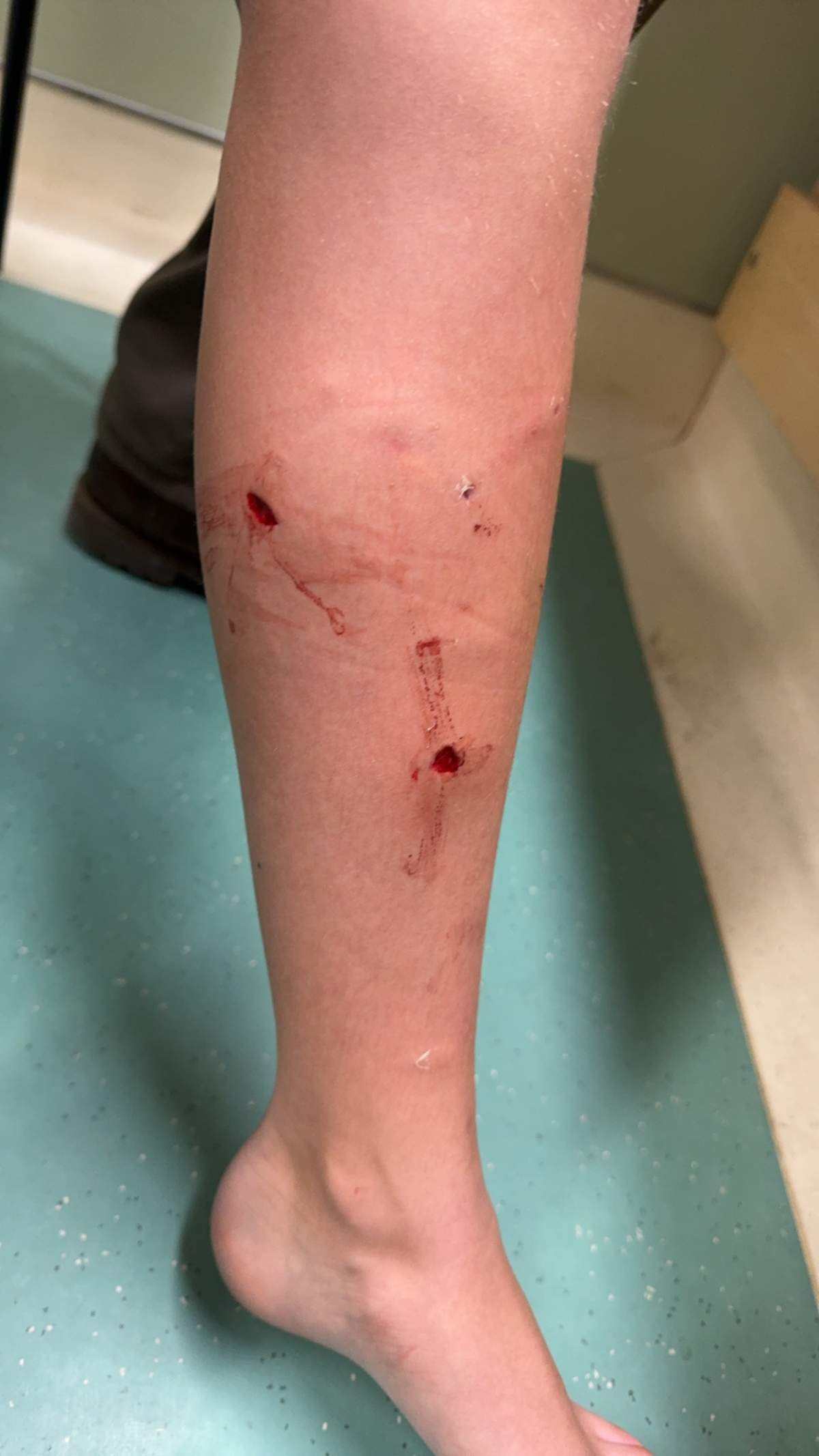 Eleven-year-old girl injured in coyote attack east of Calgary