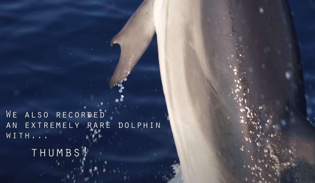The dolphin's thumbs are likely caused by a genetic abnormality, researchers say.