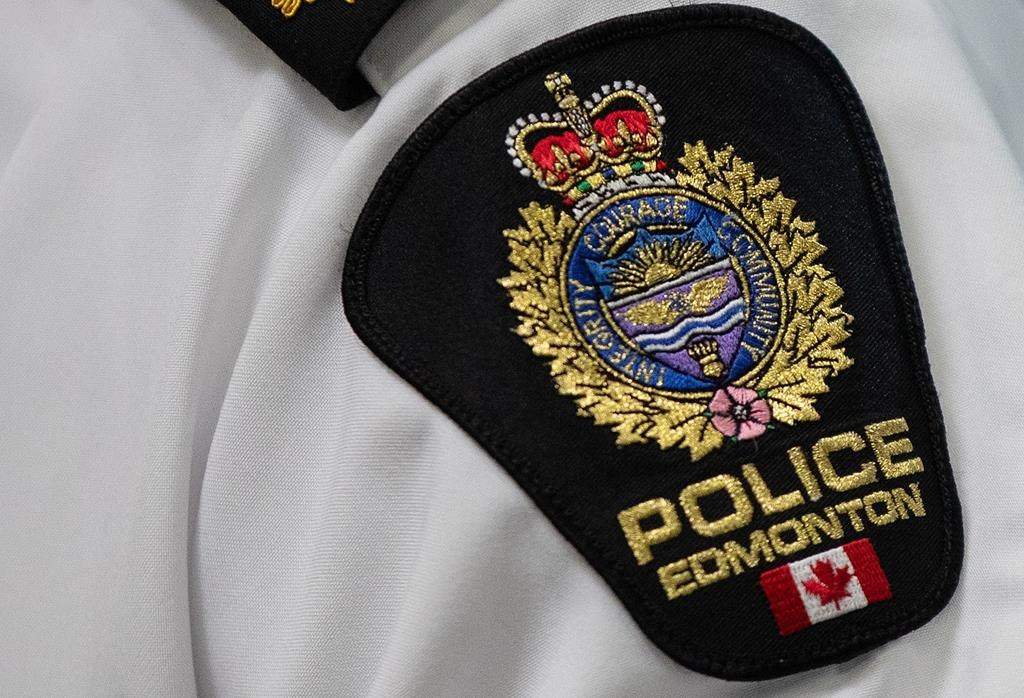 Edmonton police are investigating a dog attack that sent four people to hospital Thursday afternoon.