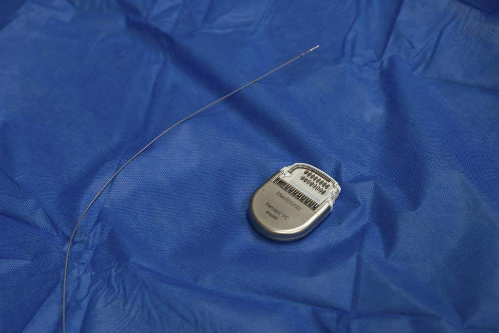 A sample pacemaker-like device, used for deep brain stimulation therapy, and its electrodes which are implanted into a specific site in the brain are displayed at Mount Sinai West in New York on Dec. 20, 2023. The device controls the amount of electrical stimulation to the brain and delivers constant low-voltage pulses. Patient Emily Hollenbeck calls it “continuous Prozac.”