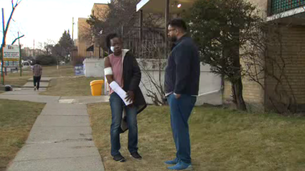 Anita Brown is injured after she says she was attacked by two dogs on Wednesday in Toronto.