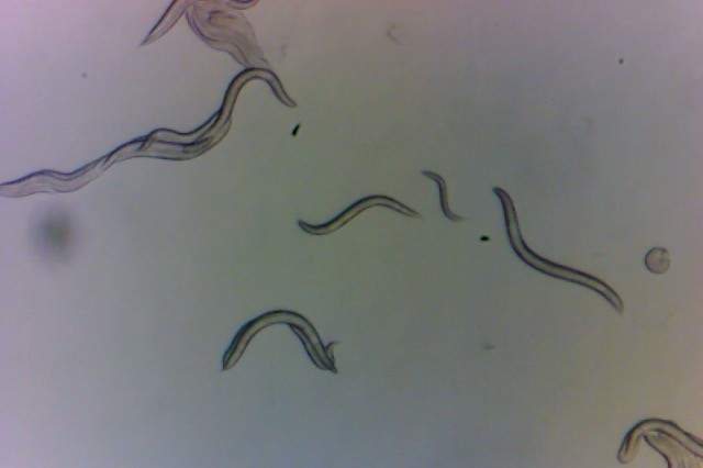 Worms collected in the Chornobyl Exclusion Zone, as seen under a microscope.