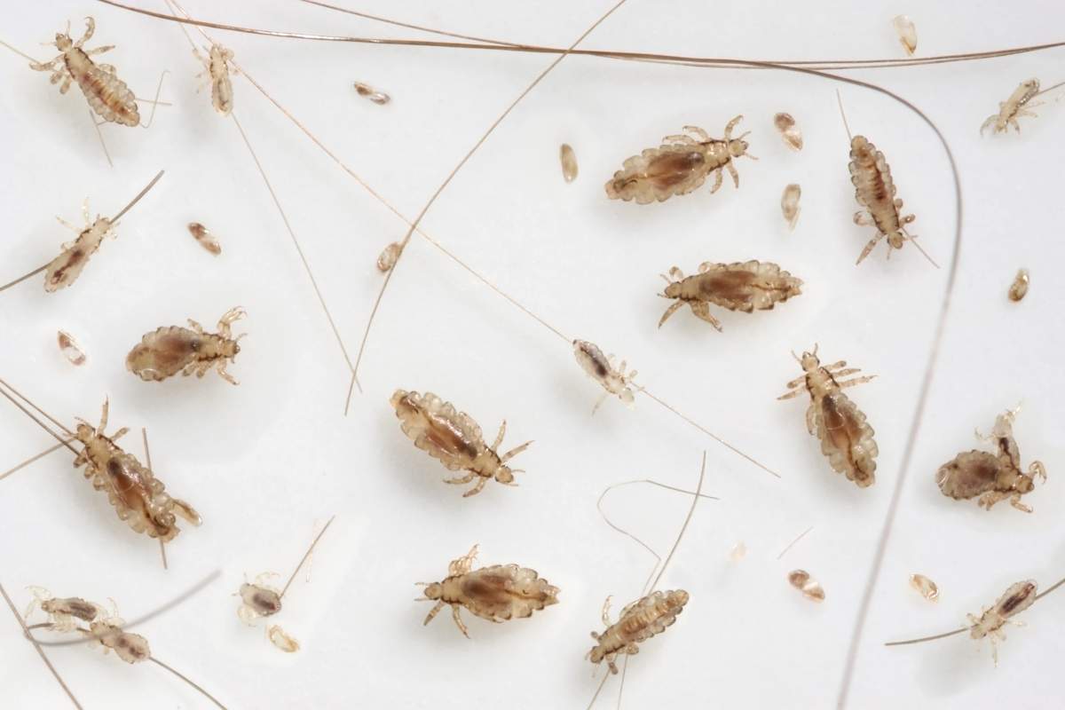 Experts say drug-resistant 'super lice' are becoming more common, frustrating families and prompting reminders about early detection, proper treatment and school procedures.