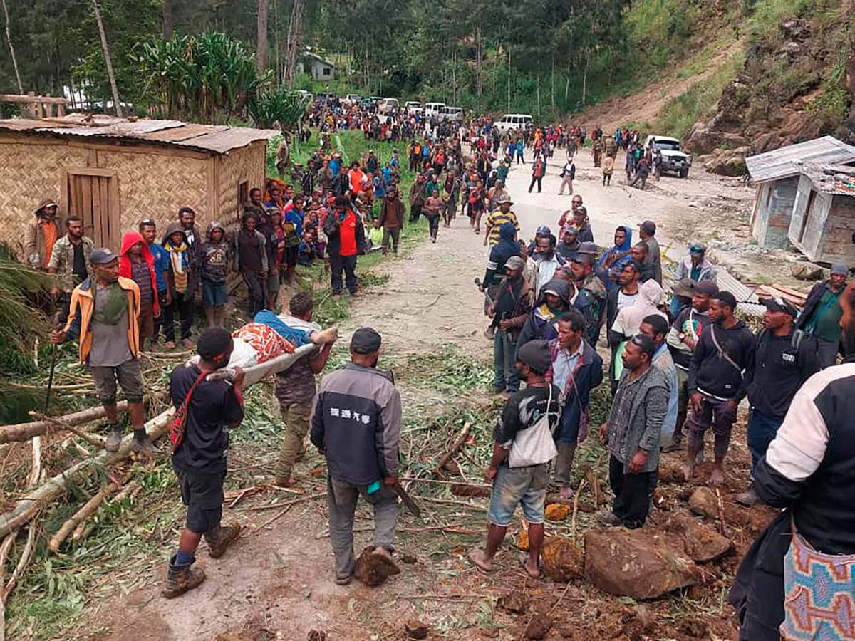 In this photo provides the International Organization for Migration, an injured person is carried on a stretcher to seek medical assistance after a landslide in Yambali village, Papua New Guinea, Friday, May 24, 2024. More than 100 people are believed to have been killed in the landslide that buried a village and an emergency response is underway, officials in the South Pacific island nation said. The landslide struck Enga province, about 600 kilometers (370 miles) northwest of the capital, Port Moresby, at roughly 3 a.m., Australian Broadcasting Corp. reported. (Benjamin Sipa/International Organization for Migration via AP)