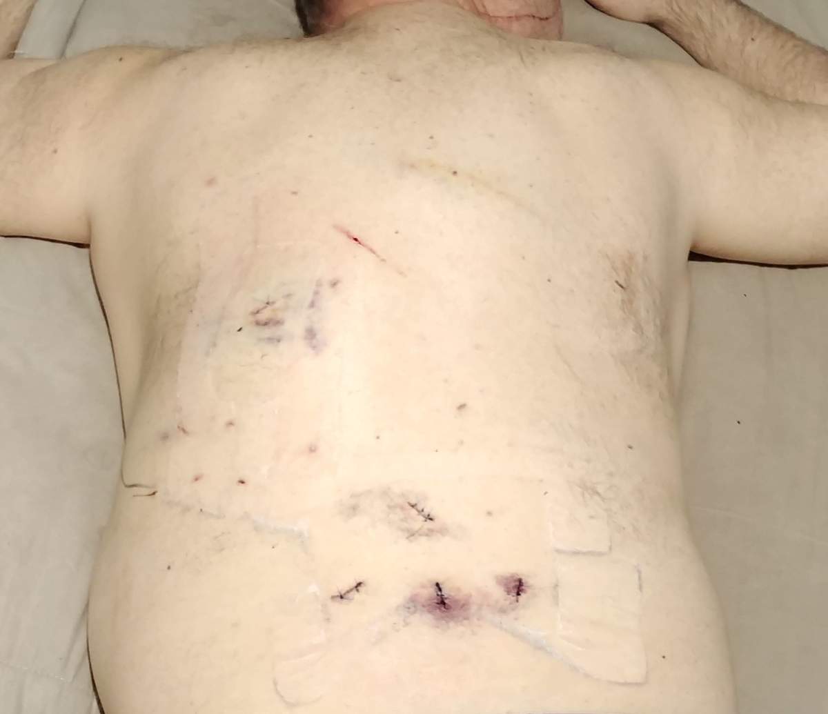 Man stabbed in attack in Edmonton on May 5, 2024.